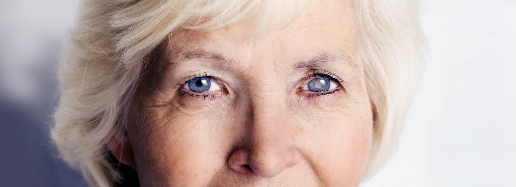 Cataract Surgery in Pleasanton